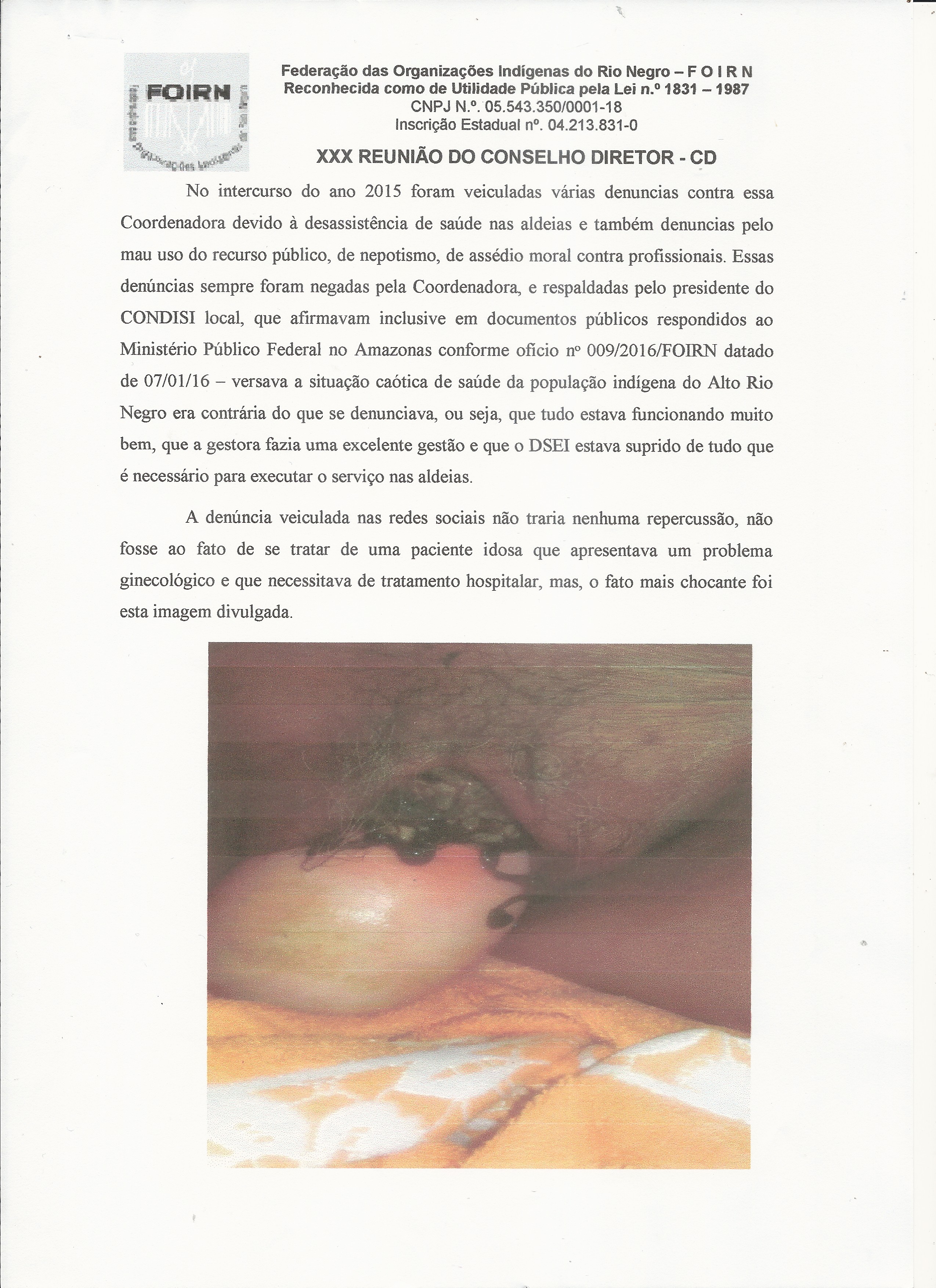 Carta Denúncia XXX CD FOIRN_Saúde Indígena -2